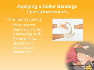 Applying a Roller Bandage
Figure-Eight Method (5 of 7)
• For hand (cont’d):
• Make several
figure-eight turns,
overlapping each.
• Finish with two
straight turns
around wrist;
secure end.
 
