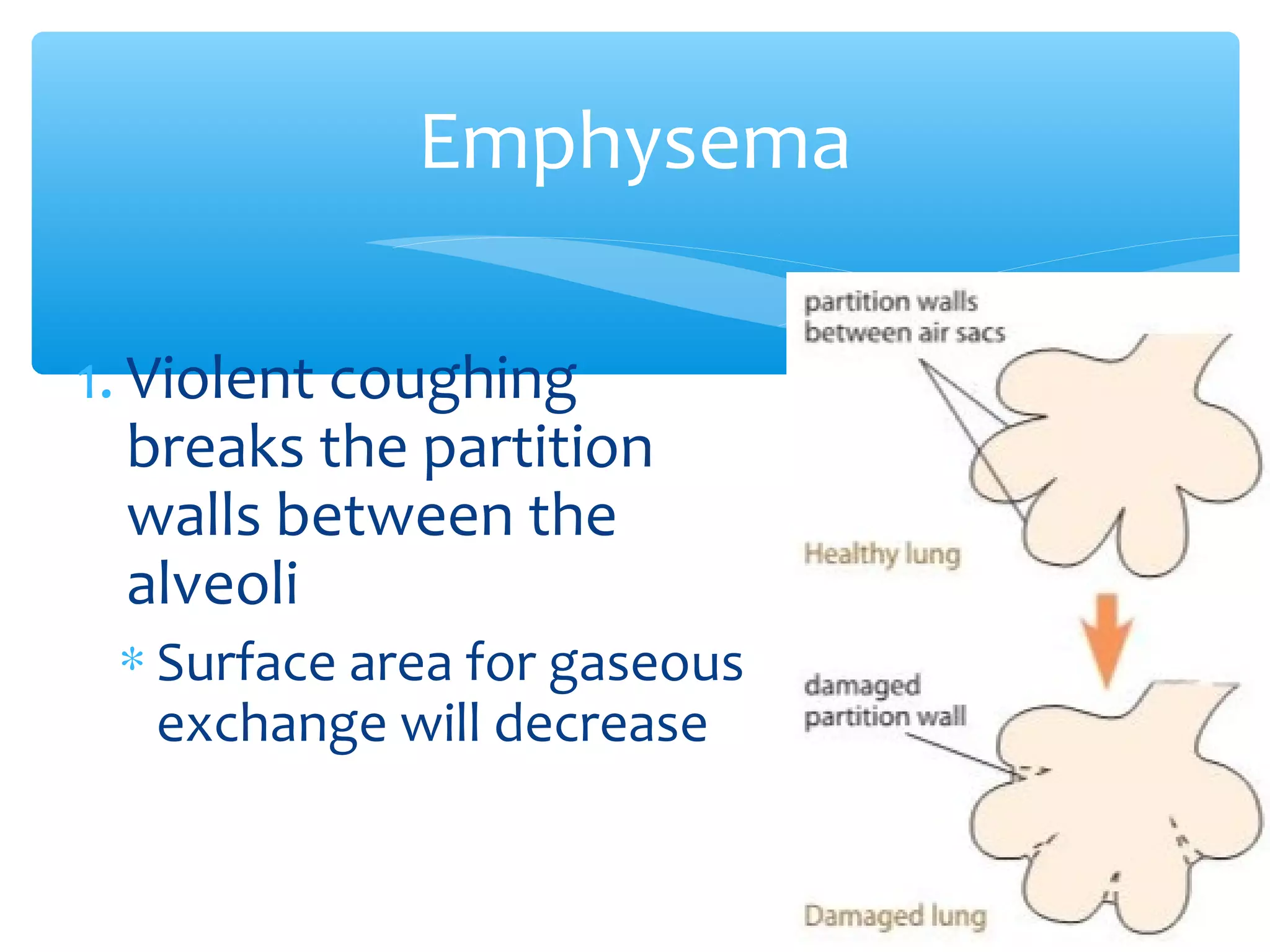 1. Violent coughing
breaks the partition
walls between the
alveoli
∗ Surface area for gaseous
exchange will decrease
Emphysema
 