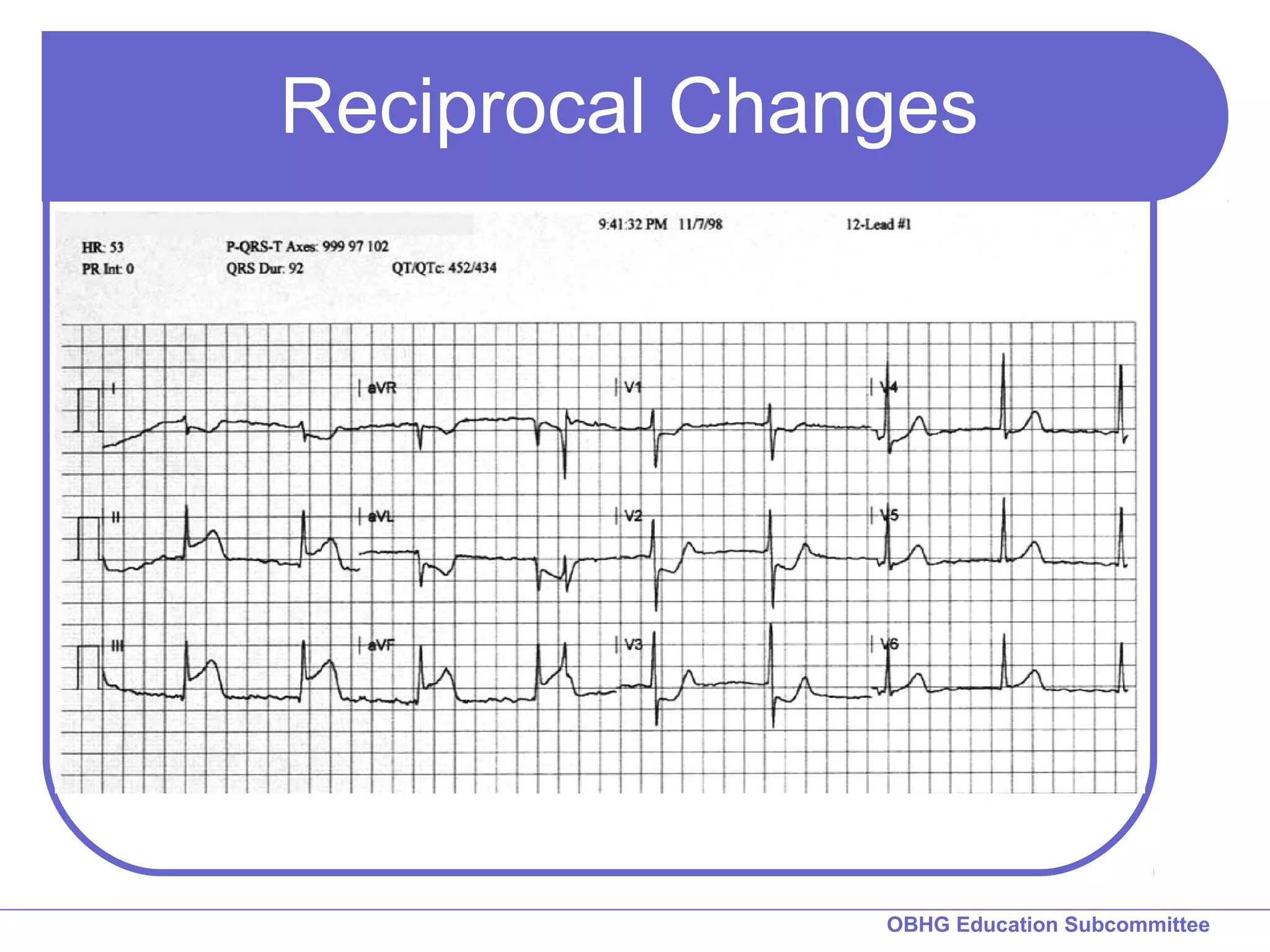 Reciprocal Changes 
OBHG Education Subcommittee 
 