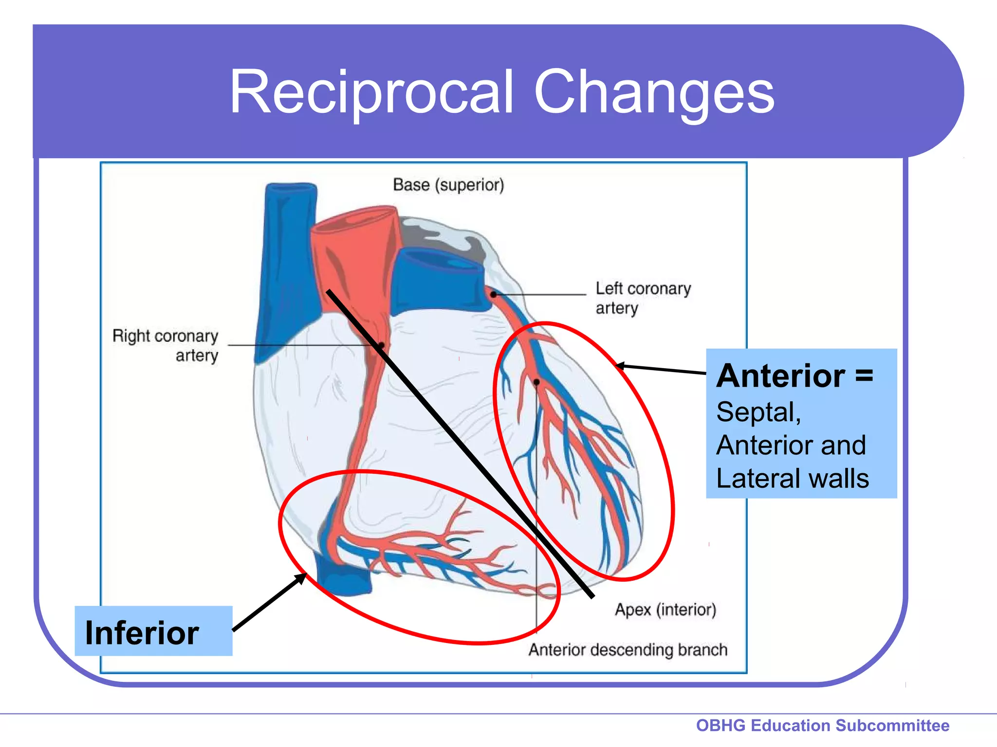 Reciprocal Changes 
OBHG Education Subcommittee 
Inferior 
Anterior = 
Septal, 
Anterior and 
Lateral walls 
 