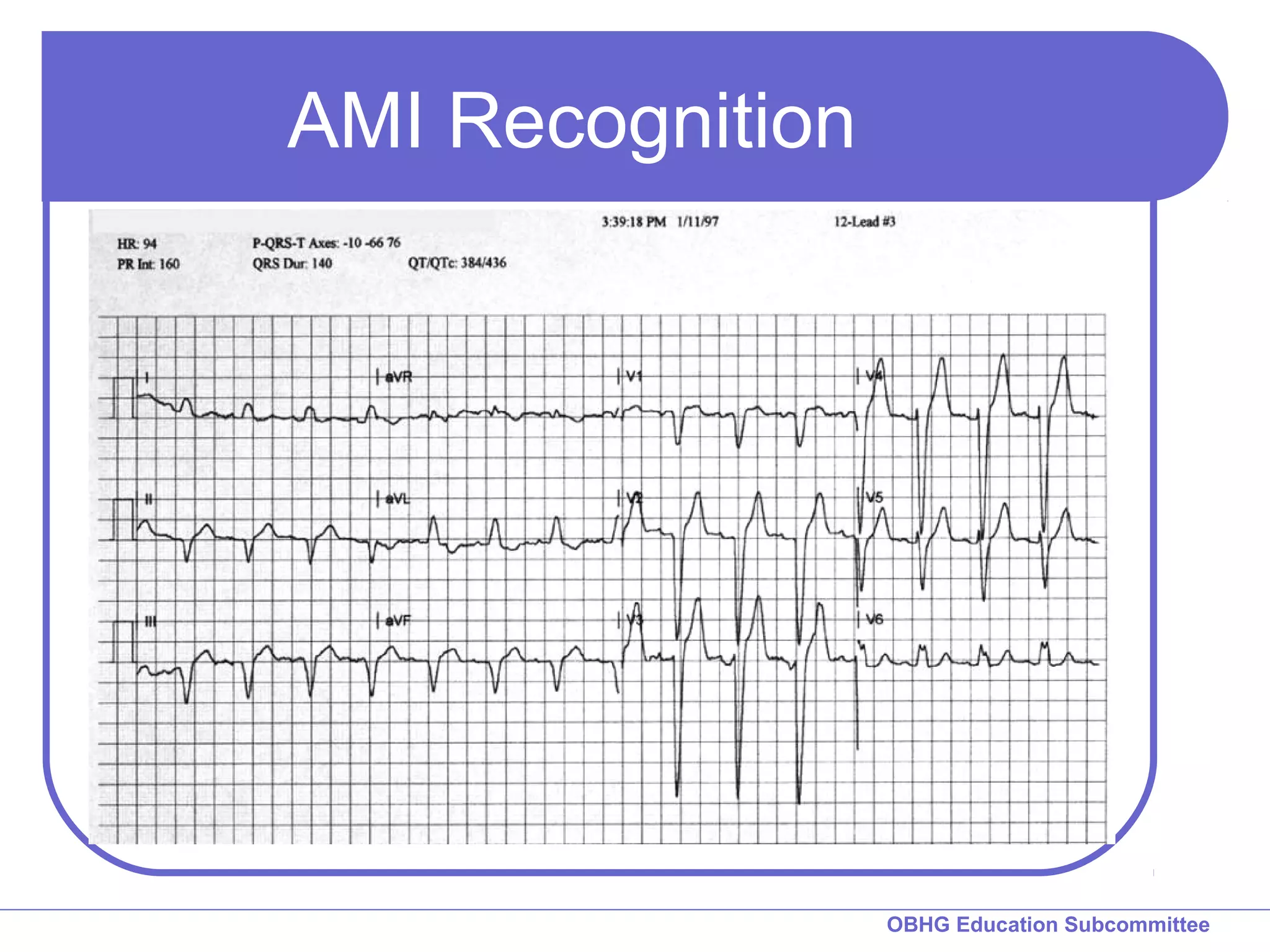 OBHG Education Subcommittee 
AMI Recognition 
 