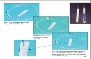 Wheel Bacteriogram Chapter 10 Biochemical tests.pptx bacteriology | PPTX