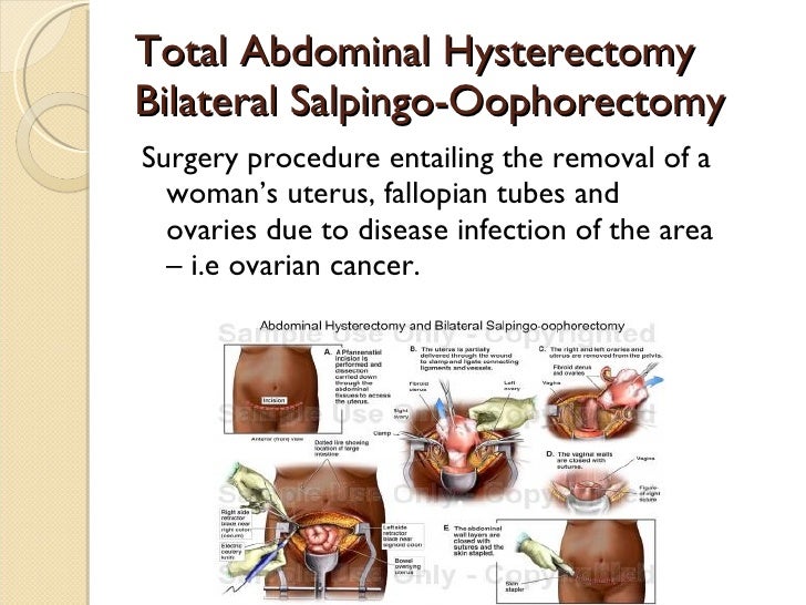 Chapter 10 presentation the reproductive system