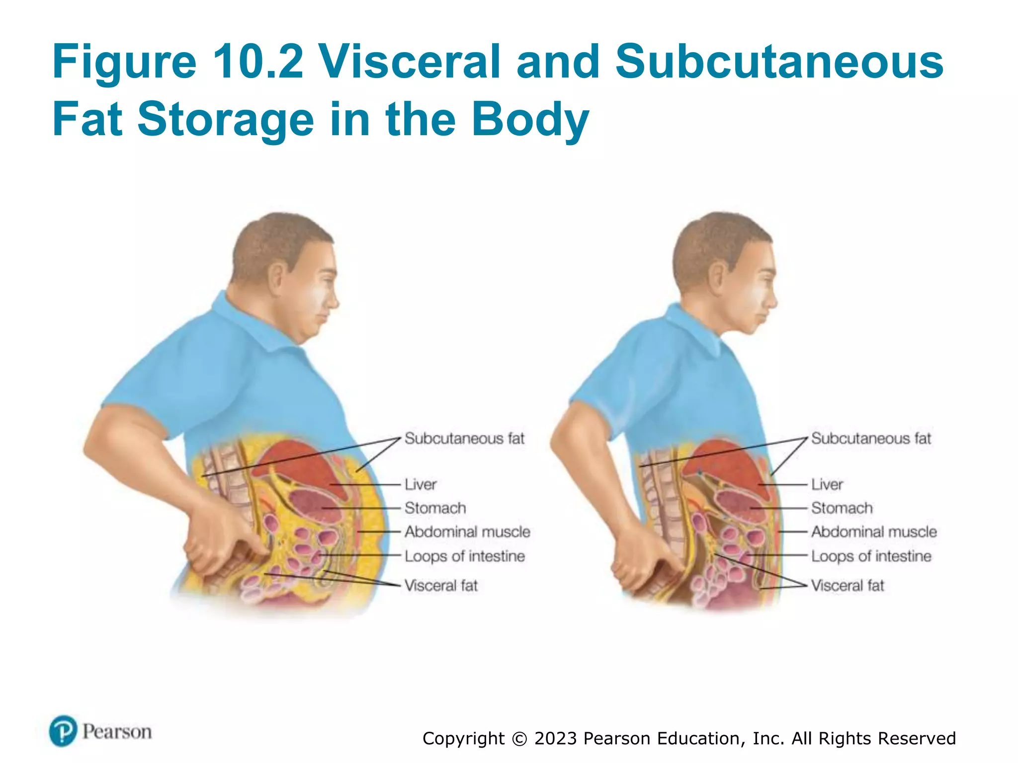 CHAPTER 10 WEIGHT MANAGEMENT.pptx