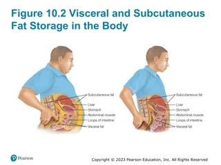 Copyright © 2023 Pearson Education, Inc. All Rights Reserved
Figure 10.2 Visceral and Subcutaneous
Fat Storage in the Body
 