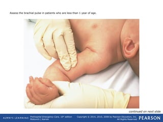 Prehospital Emergency Care, 10th
edition
Mistovich | Karren
Copyright © 2014, 2010, 2008 by Pearson Education, Inc.
All Rights Reserved
Assess the brachial pulse in patients who are less than 1 year of age.
continued on next slide
 