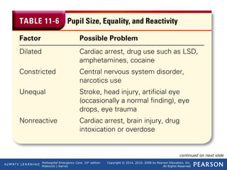 Prehospital Emergency Care, 10th
edition
Mistovich | Karren
Copyright © 2014, 2010, 2008 by Pearson Education, Inc.
All Rights Reserved
Table 11-6 Pupil Size, Equality, and Reactivity
continued on next slide
 