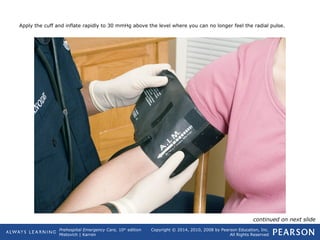 Prehospital Emergency Care, 10th
edition
Mistovich | Karren
Copyright © 2014, 2010, 2008 by Pearson Education, Inc.
All Rights Reserved
Apply the cuff and inflate rapidly to 30 mmHg above the level where you can no longer feel the radial pulse.
continued on next slide
 