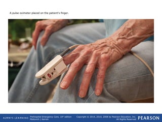 Prehospital Emergency Care, 10th
edition
Mistovich | Karren
Copyright © 2014, 2010, 2008 by Pearson Education, Inc.
All Rights Reserved
A pulse oximeter placed on the patient's finger.
 