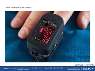 Prehospital Emergency Care, 10th
edition
Mistovich | Karren
Copyright © 2014, 2010, 2008 by Pearson Education, Inc.
All Rights Reserved
A mini "finger-size" pulse oximeter.
continued on next slide
 