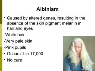 Albinism Caused by altered genes, resulting in the absence of the skin pigment melanin in hair and eyes  -White hair -Very pale skin -Pink pupils Occurs 1 in 17,000 No cure 