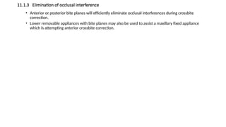 11.1.3 Elimination of occlusal interference
• Anterior or posterior bite planes will efficiently eliminate occlusal interferences during crossbite
correction.
• Lower removable appliances with bite planes may also be used to assist a maxillary fixed appliance
which is attempting anterior crossbite correction.
 