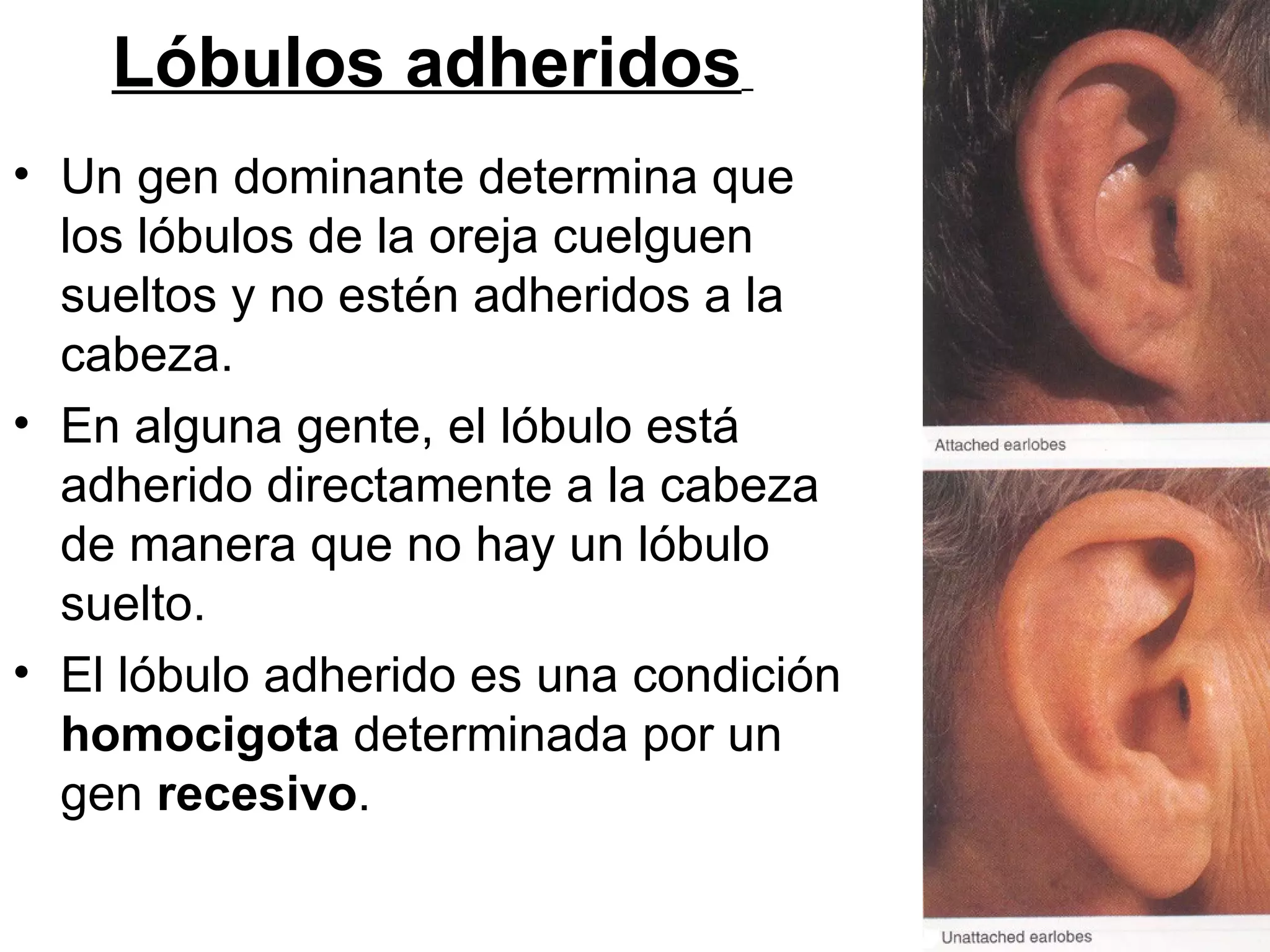 Lóbulos adheridos
• Un gen dominante determina que
  los lóbulos de la oreja cuelguen
  sueltos y no estén adheridos a la
  cabeza.
• En alguna gente, el lóbulo está
  adherido directamente a la cabeza
  de manera que no hay un lóbulo
  suelto.
• El lóbulo adherido es una condición
  homocigota determinada por un
  gen recesivo.
 