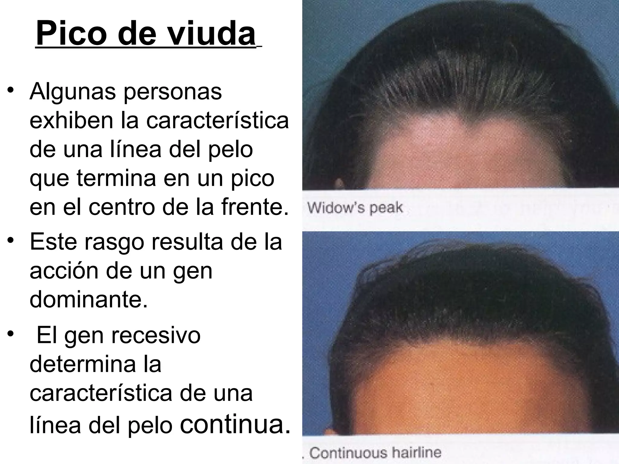 Pico de viuda
• Algunas personas
  exhiben la característica
  de una línea del pelo
  que termina en un pico
  en el centro de la frente.
• Este rasgo resulta de la
  acción de un gen
  dominante.
• El gen recesivo
  determina la
  característica de una
  línea del pelo continua.
 