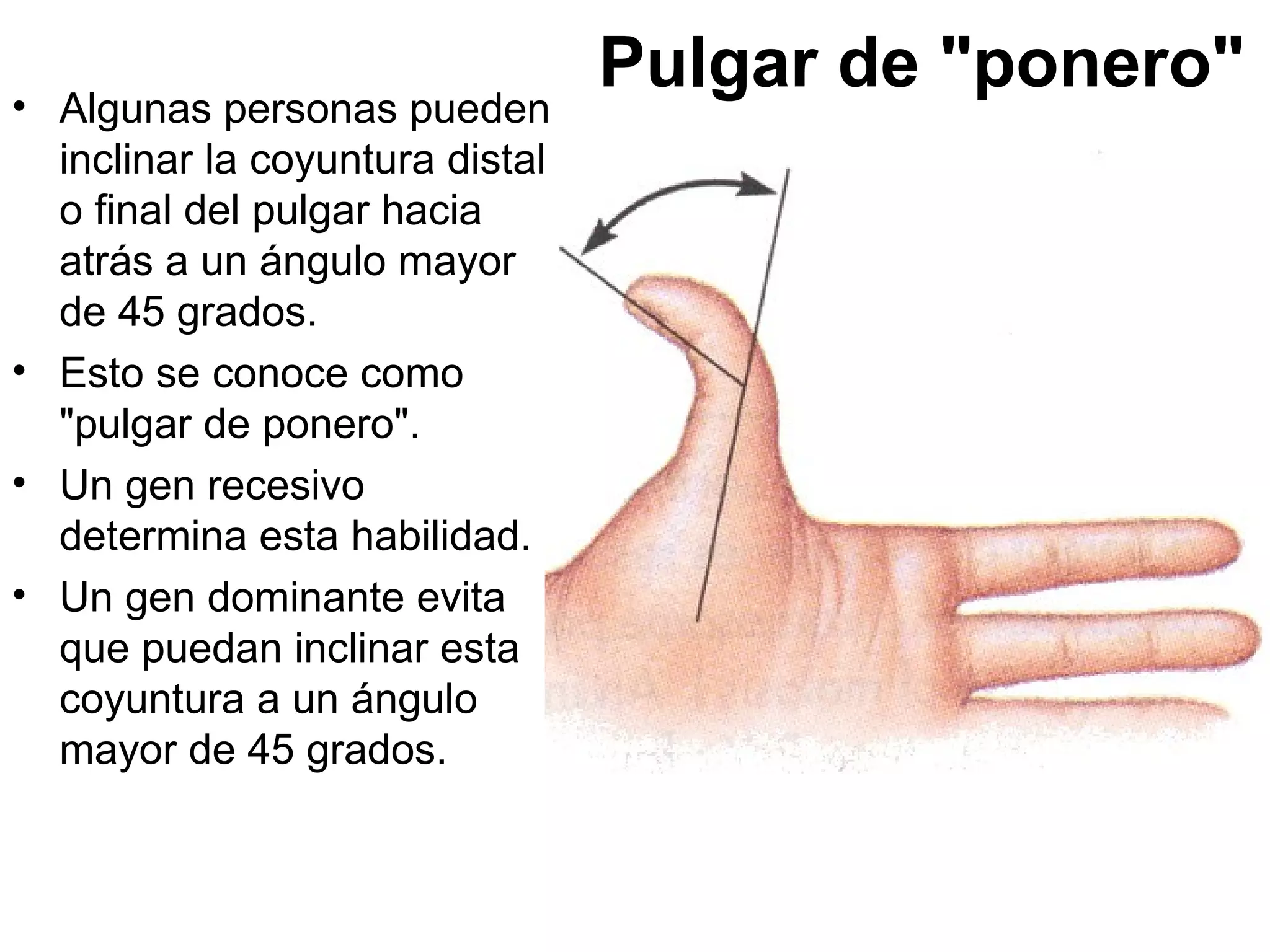 • Algunas personas pueden
                                 Pulgar de "ponero"
  inclinar la coyuntura distal
  o final del pulgar hacia
  atrás a un ángulo mayor
  de 45 grados.
• Esto se conoce como
  "pulgar de ponero".
• Un gen recesivo
  determina esta habilidad.
• Un gen dominante evita
  que puedan inclinar esta
  coyuntura a un ángulo
  mayor de 45 grados.
 