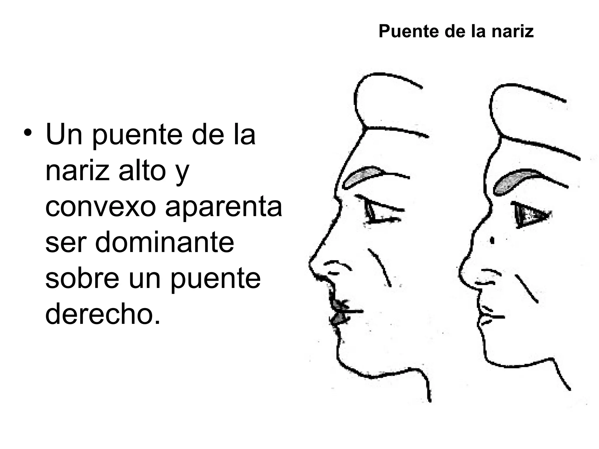 Puente de la nariz




• Un puente de la
  nariz alto y
  convexo aparenta
  ser dominante
  sobre un puente
  derecho.
 