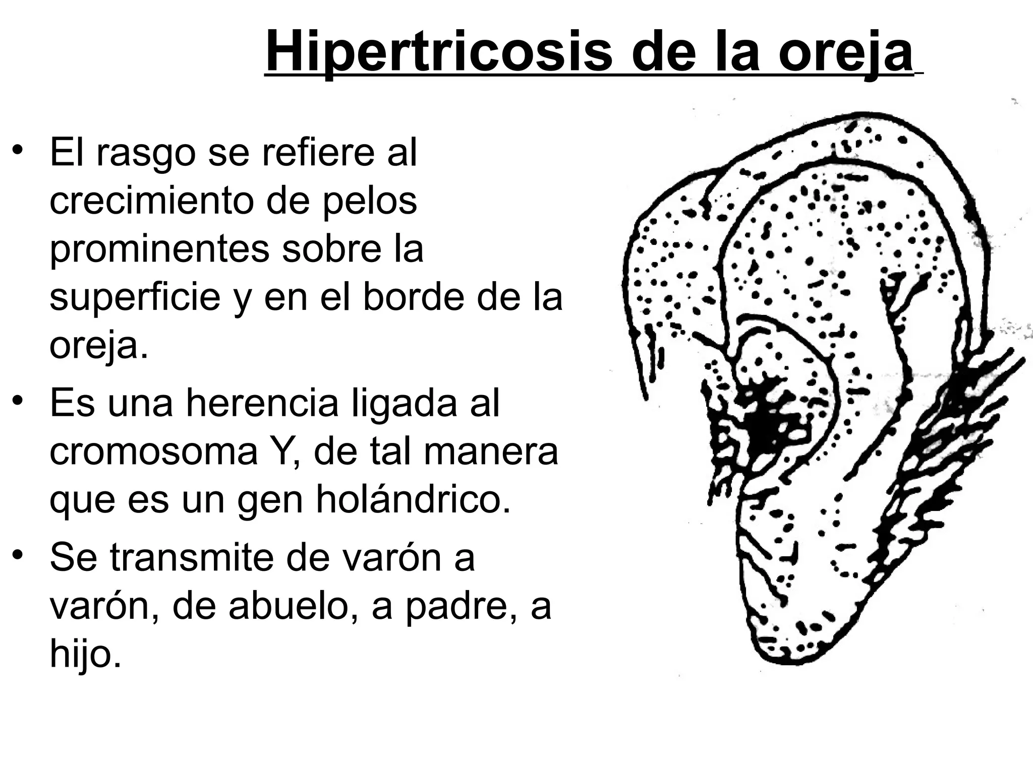 Hipertricosis de la oreja
• El rasgo se refiere al
  crecimiento de pelos
  prominentes sobre la
  superficie y en el borde de la
  oreja.
• Es una herencia ligada al
  cromosoma Y, de tal manera
  que es un gen holándrico.
• Se transmite de varón a
  varón, de abuelo, a padre, a
  hijo.
 
