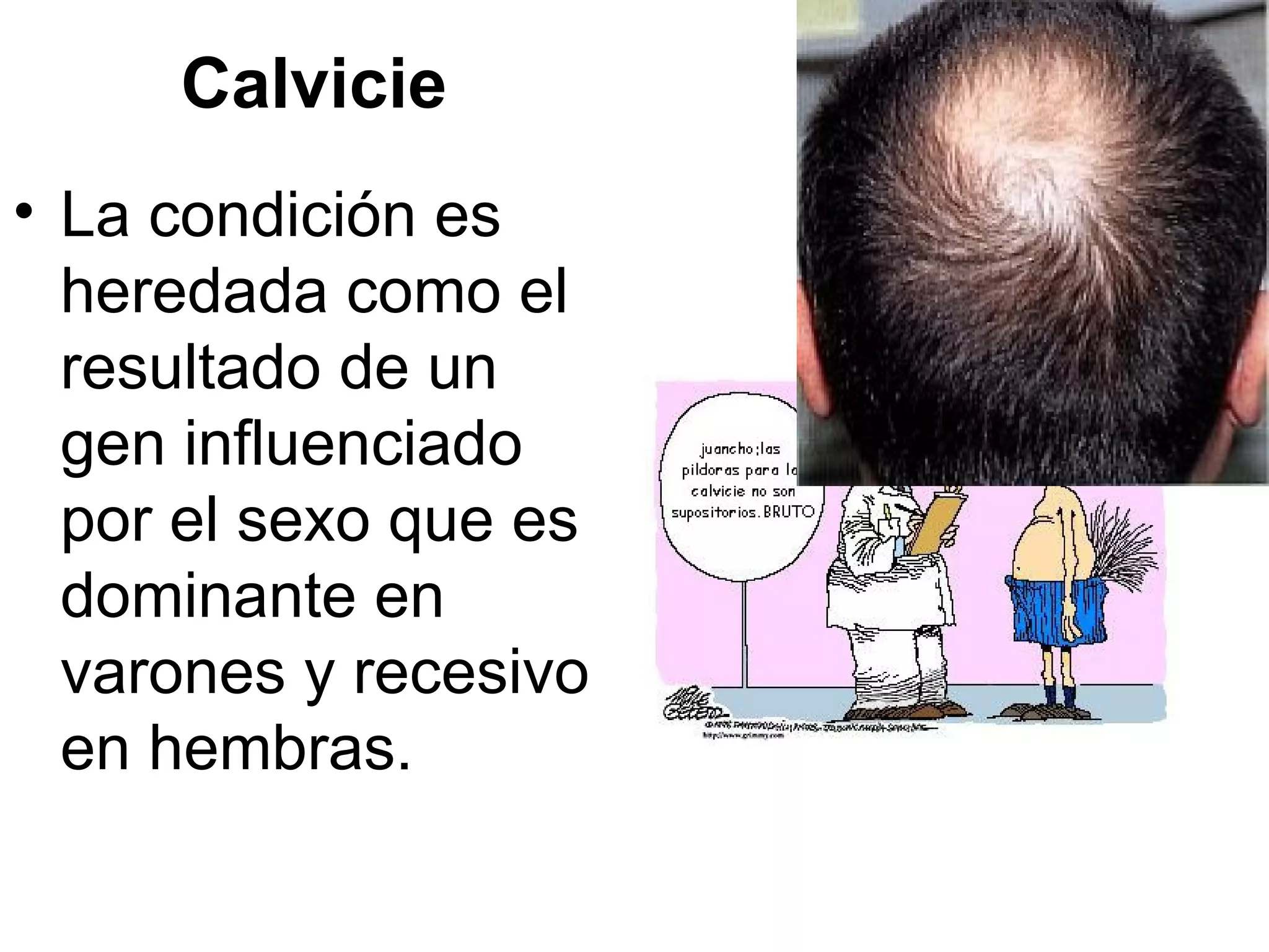 Calvicie
• La condición es
  heredada como el
  resultado de un
  gen influenciado
  por el sexo que es
  dominante en
  varones y recesivo
  en hembras.
 
