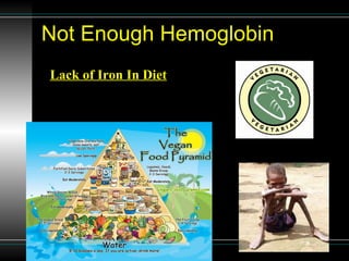Not Enough Hemoglobin Lack of Iron In Diet   