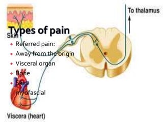  Referred pain:
 Away from the origin
 Visceral organ
 Bone
 Skin
 myofascial
 