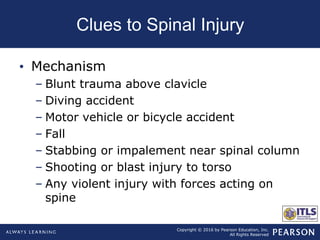 Copyright © 2016 by Pearson Education, Inc.
All Rights Reserved
Clues to Spinal Injury
• Mechanism
– Blunt trauma above clavicle
– Diving accident
– Motor vehicle or bicycle accident
– Fall
– Stabbing or impalement near spinal column
– Shooting or blast injury to torso
– Any violent injury with forces acting on
spine
 