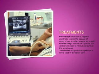 treatmentsNerve block- injection of regional anesthetic to stop the passage of sensory/pain impulses along a nerve pathLaminectomy- removal of a portion of a vertebra in order to relieve pressure on the spinal nerveTractotomy- surgical interruption of a nerve tract in the spinal cord