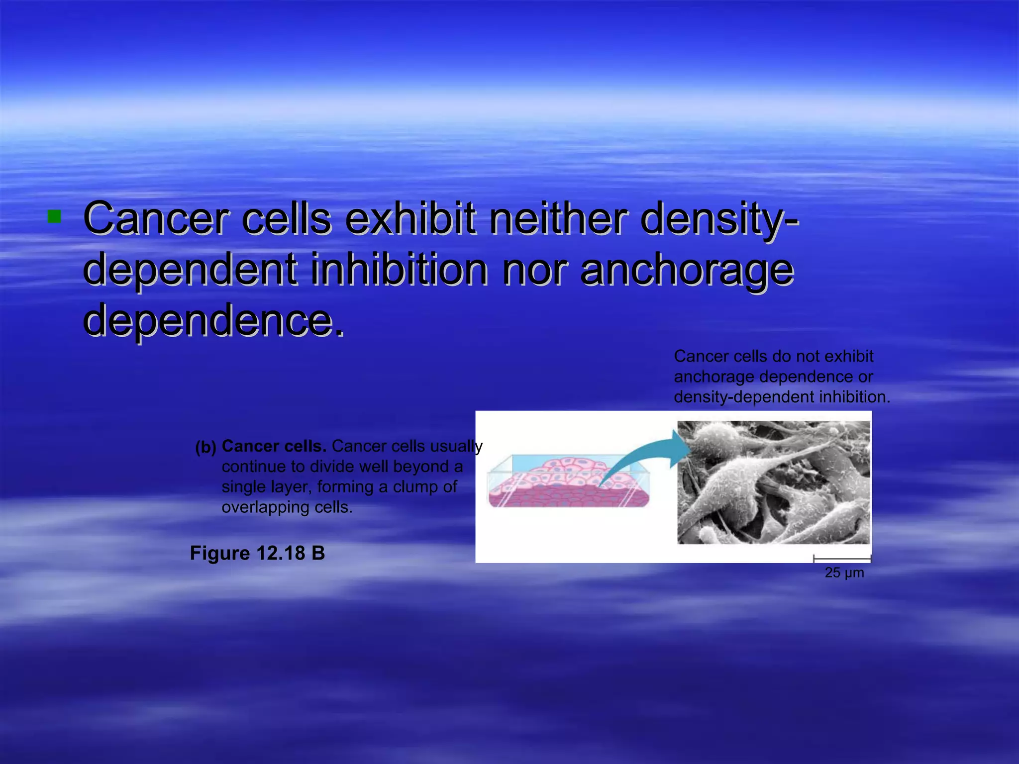 Cancer cells exhibit neither density-dependent inhibition nor anchorage dependence. 25 µm Cancer cells do not exhibit anchorage dependence or  density-dependent inhibition. Cancer cells.  Cancer cells usually  continue to divide well beyond a  single layer, forming a clump of  overlapping cells. (b) Figure 12.18 B 