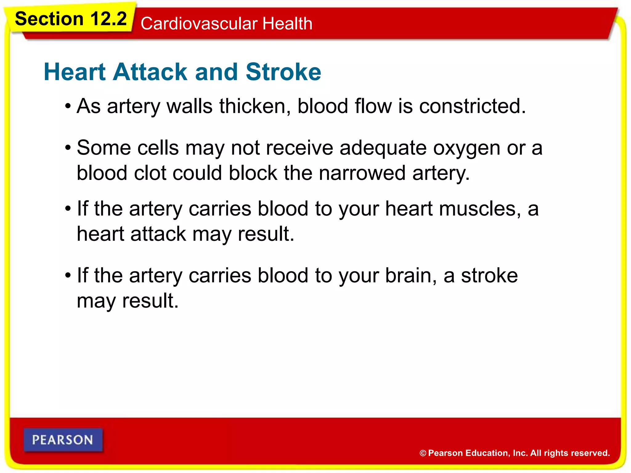 Section 12.2 Cardiovascular Health
• As artery walls thicken, blood flow is constricted.
Heart Attack and Stroke
• Some cells may not receive adequate oxygen or a
blood clot could block the narrowed artery.
• If the artery carries blood to your heart muscles, a
heart attack may result.
• If the artery carries blood to your brain, a stroke
may result.
 