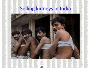 Selling kidneys in India
 