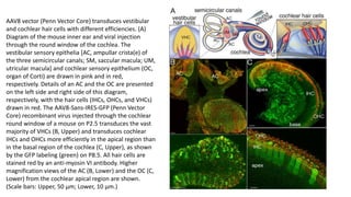 AAV8 vector (Penn Vector Core) transduces vestibular
and cochlear hair cells with different efficiencies. (A)
Diagram of the mouse inner ear and viral injection
through the round window of the cochlea. The
vestibular sensory epithelia [AC, ampullar crista(e) of
the three semicircular canals; SM, saccular macula; UM,
utricular macula] and cochlear sensory epithelium (OC,
organ of Corti) are drawn in pink and in red,
respectively. Details of an AC and the OC are presented
on the left side and right side of this diagram,
respectively, with the hair cells (IHCs, OHCs, and VHCs)
drawn in red. The AAV8-Sans-IRES-GFP (Penn Vector
Core) recombinant virus injected through the cochlear
round window of a mouse on P2.5 transduces the vast
majority of VHCs (B, Upper) and transduces cochlear
IHCs and OHCs more efficiently in the apical region than
in the basal region of the cochlea (C, Upper), as shown
by the GFP labeling (green) on P8.5. All hair cells are
stained red by an anti-myosin VI antibody. Higher
magnification views of the AC (B, Lower) and the OC (C,
Lower) from the cochlear apical region are shown.
(Scale bars: Upper, 50 μm; Lower, 10 μm.)
 