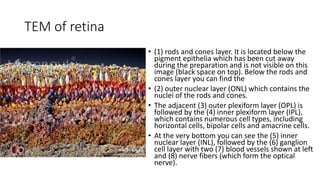 TEM of retina
• (1) rods and cones layer. It is located below the
pigment epithelia which has been cut away
during the preparation and is not visible on this
image (black space on top). Below the rods and
cones layer you can find the
• (2) outer nuclear layer (ONL) which contains the
nuclei of the rods and cones.
• The adjacent (3) outer plexiform layer (OPL) is
followed by the (4) inner plexiform layer (IPL),
which contains numerous cell types, including
horizontal cells, bipolar cells and amacrine cells.
• At the very bottom you can see the (5) inner
nuclear layer (INL), followed by the (6) ganglion
cell layer with two (7) blood vessels shown at left
and (8) nerve fibers (which form the optical
nerve).
 
