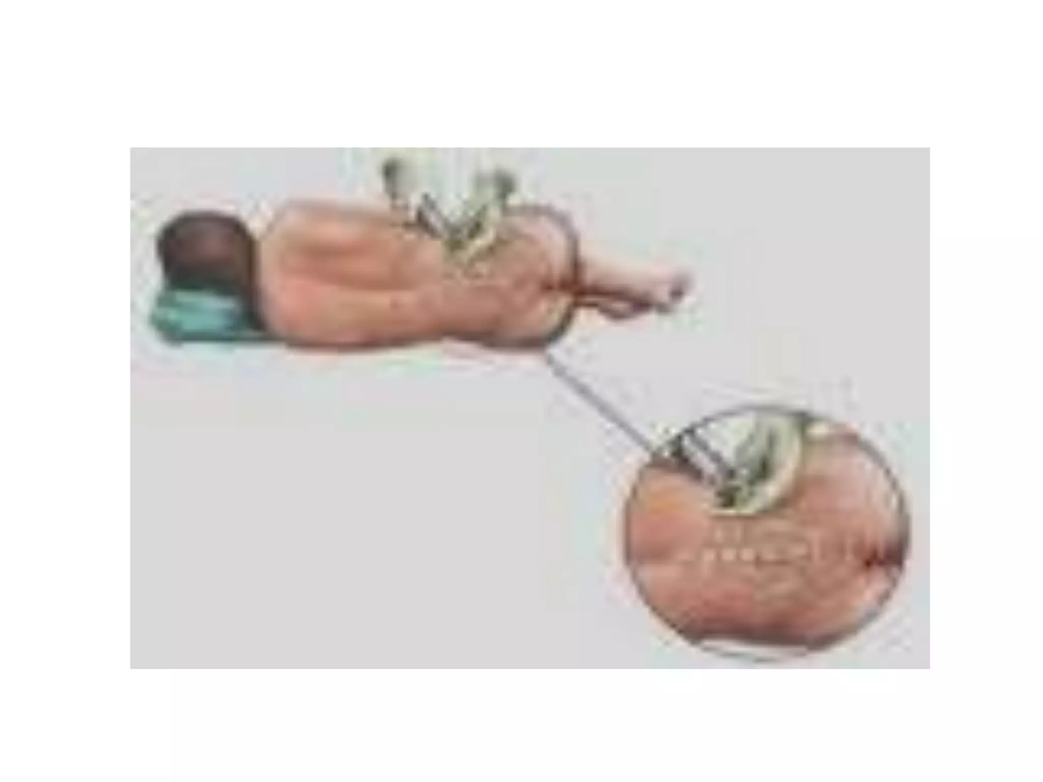 Chapter 12 The Nervous System