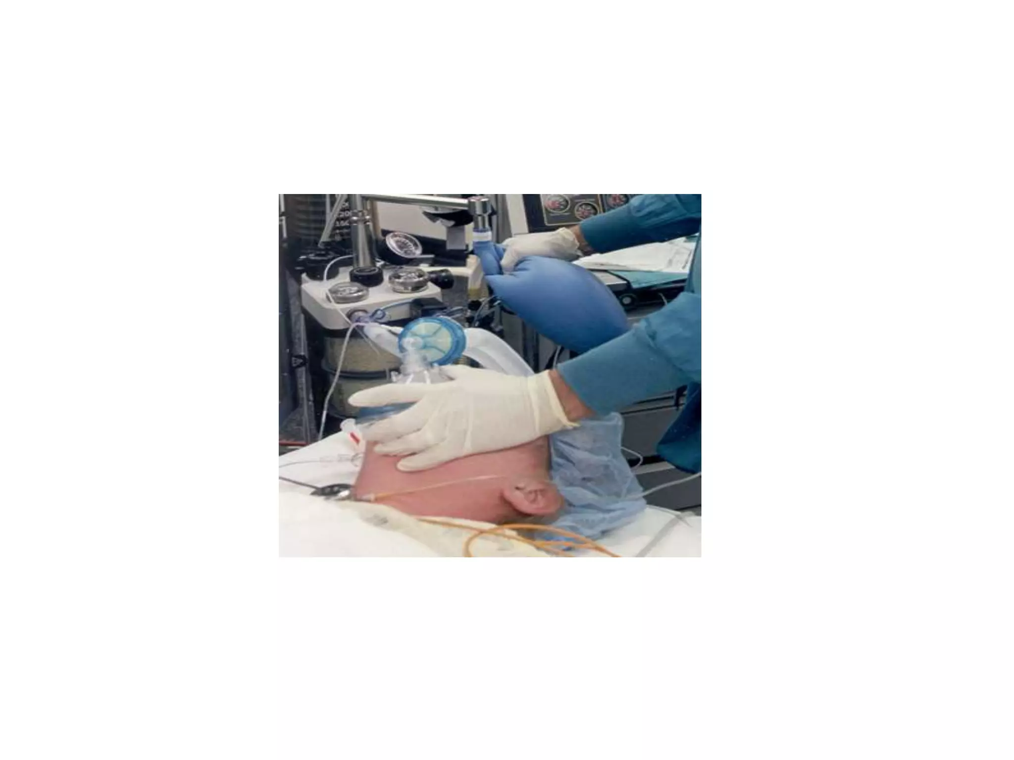 Chapter 12 The Nervous System