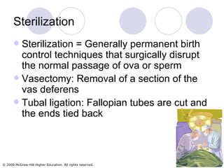 Sterilization Sterilization = Generally permanent birth control techniques that surgically disrupt the normal passage of ova or sperm Vasectomy: Removal of a section of the vas deferens Tubal ligation: Fallopian tubes are cut and the ends tied back 