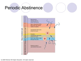 Periodic Abstinence 