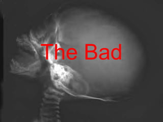 The Bad 
