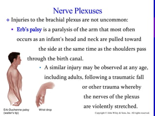 Copyright © John Wiley & Sons, Inc. All rights reserved.
Nerve Plexuses
 Injuries to the brachial plexus are not uncommon:
 Erb’s palsy is a paralysis of the arm that most often
occurs as an infant's head and neck are pulled toward
the side at the same time as the shoulders pass
through the birth canal.
• A similar injury may be observed at any age,
including adults, following a traumatic fall
or other trauma whereby
the nerves of the plexus
are violently stretched.
 