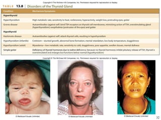 Copyright  ©  The McGraw-Hill Companies, Inc. Permission required for reproduction or display. © Mediscan/Visuals Unlimited   © Mediscan/Visuals Unlimited   © Mediscan/Visuals Unlimited   