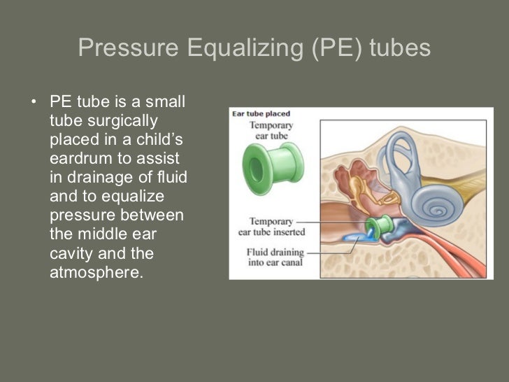 Chapter 13 abbreviations
