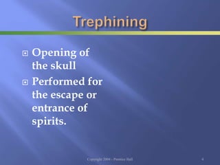  Opening of
the skull
 Performed for
the escape or
entrance of
spirits.
Copyright 2004 - Prentice Hall 4
 
