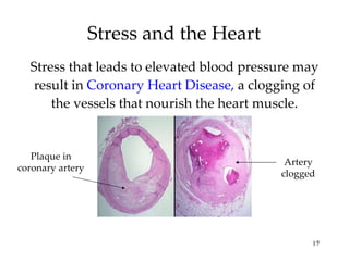 Stress and the Heart Stress that leads to elevated blood pressure may result in  Coronary Heart Disease,  a clogging of the vessels that nourish the heart muscle. Plaque in coronary artery Artery clogged 