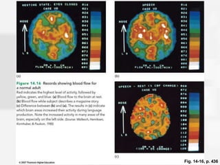 Fig. 14-16, p. 436 