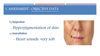 Endocrine Emergencies