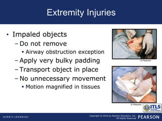 Chapter14 extremity trauma | PPT