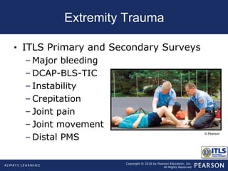 Dcapblstic Chapter14 extremity trauma | PPT