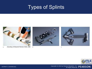 Chapter14 extremity trauma | PPT