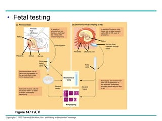 Copyright © 2005 Pearson Education, Inc. publishing as Benjamin Cummings
• Fetal testing
Figure 14.17 A, B
(a) Amniocentesis
Amniotic
fluid
withdrawn
Fetus
Placenta Uterus Cervix
Centrifugation
A sample of
amniotic fluid can
be taken starting at
the 14th to 16th
week of pregnancy.
(b) Chorionic villus sampling (CVS)
Fluid
Fetal
cells
Biochemical tests can be
Performed immediately on
the amniotic fluid or later
on the cultured cells.
Fetal cells must be cultured
for several weeks to obtain
sufficient numbers for
karyotyping.
Several
weeks
Biochemical
tests
Several
hours
Fetal
cells
Placenta Chorionic viIIi
A sample of chorionic villus
tissue can be taken as early
as the 8th to 10th week of
pregnancy.
Suction tube
Inserted through
cervix
Fetus
Karyotyping and biochemical
tests can be performed on
the fetal cells immediately,
providing results within a day
or so.
Karyotyping
 
