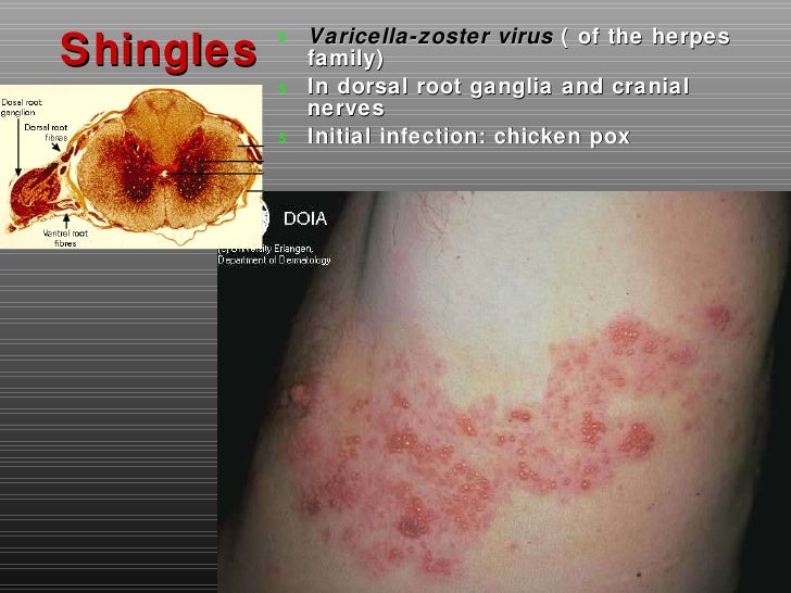 Chapter14 peripheralns marieb