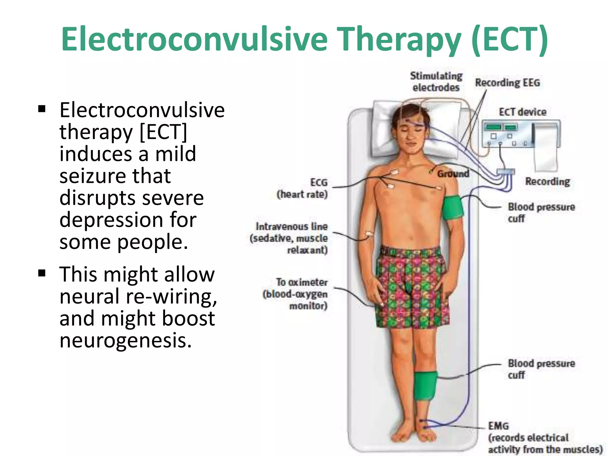 Electroconvulsive Therapy (ECT)
 Electroconvulsive
therapy [ECT]
induces a mild
seizure that
disrupts severe
depression for
some people.
 This might allow
neural re-wiring,
and might boost
neurogenesis.

 