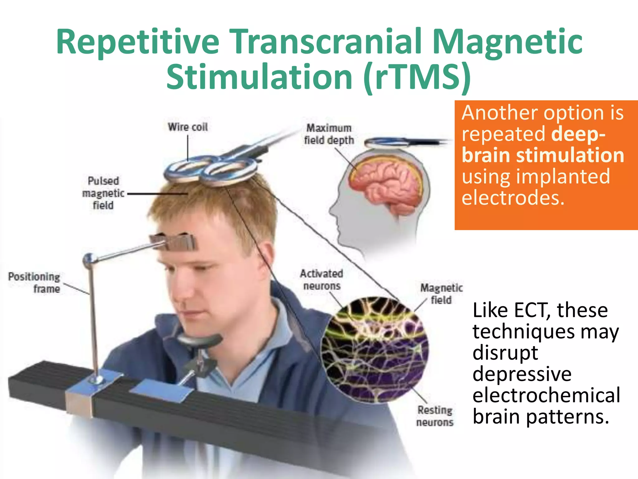 Repetitive Transcranial Magnetic
Stimulation (rTMS)
Another option is
repeated deepbrain stimulation
using implanted
electrodes.

Like ECT, these
techniques may
disrupt
depressive
electrochemical
brain patterns.

 